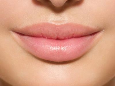 woman's lips showing lip fillers treatment